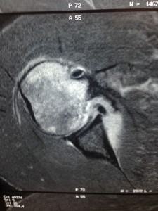 Dylan Andrews MRI axial