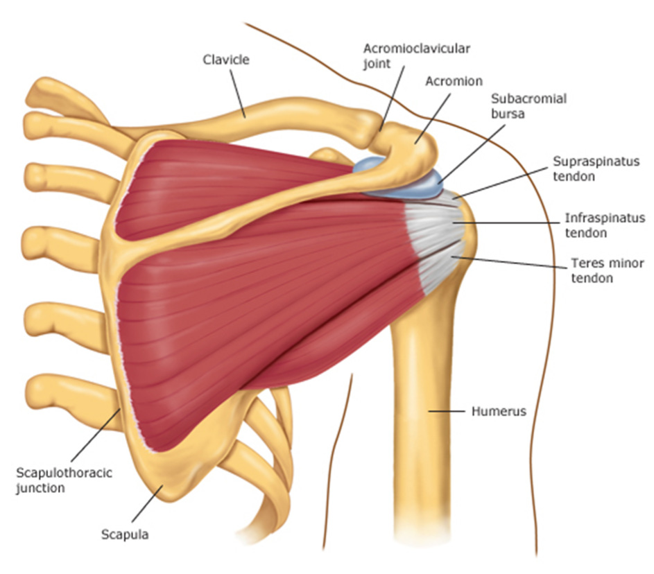 Impingement syndrome